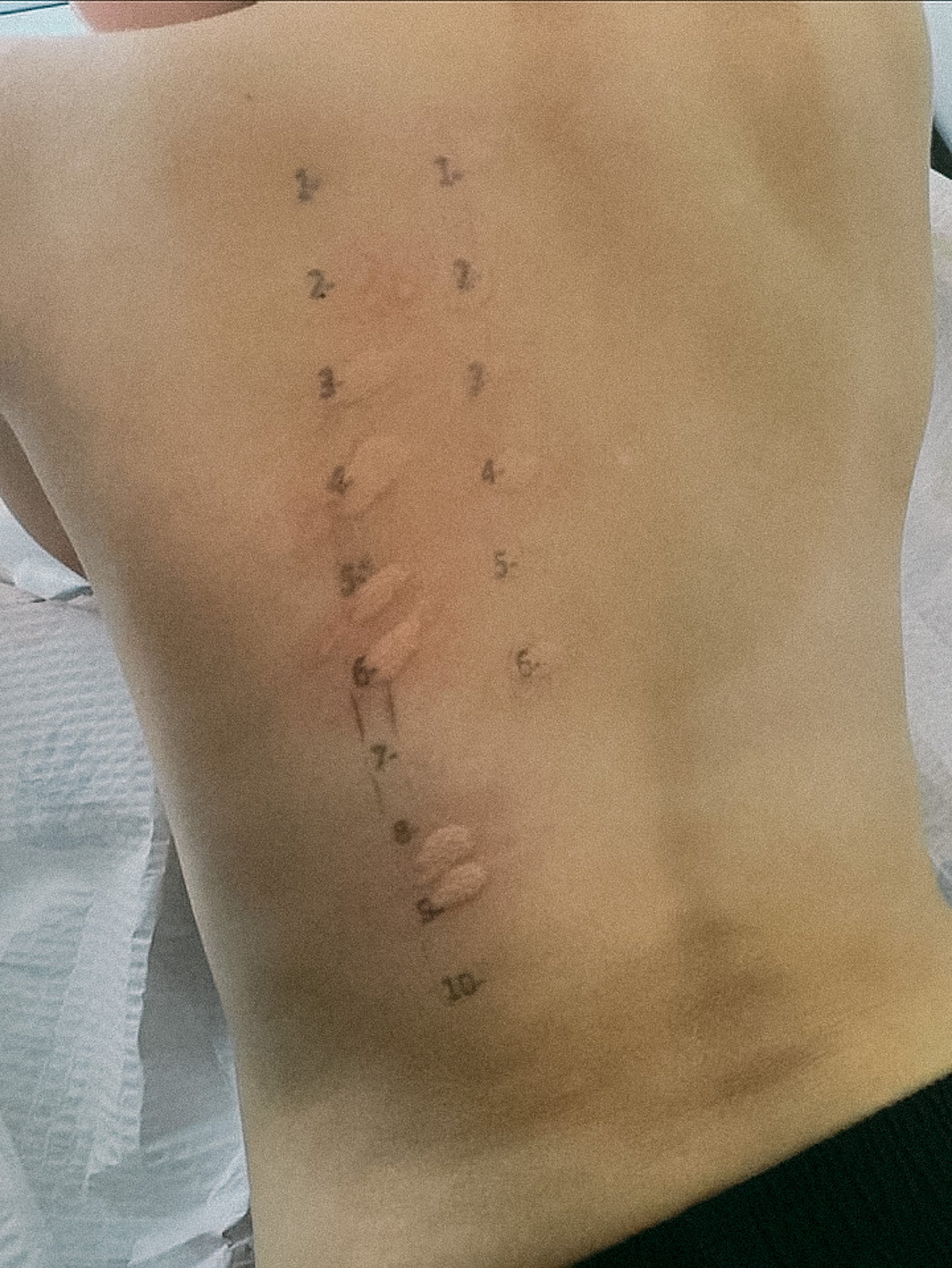 Allergy and Sensitivity Healing Bundle