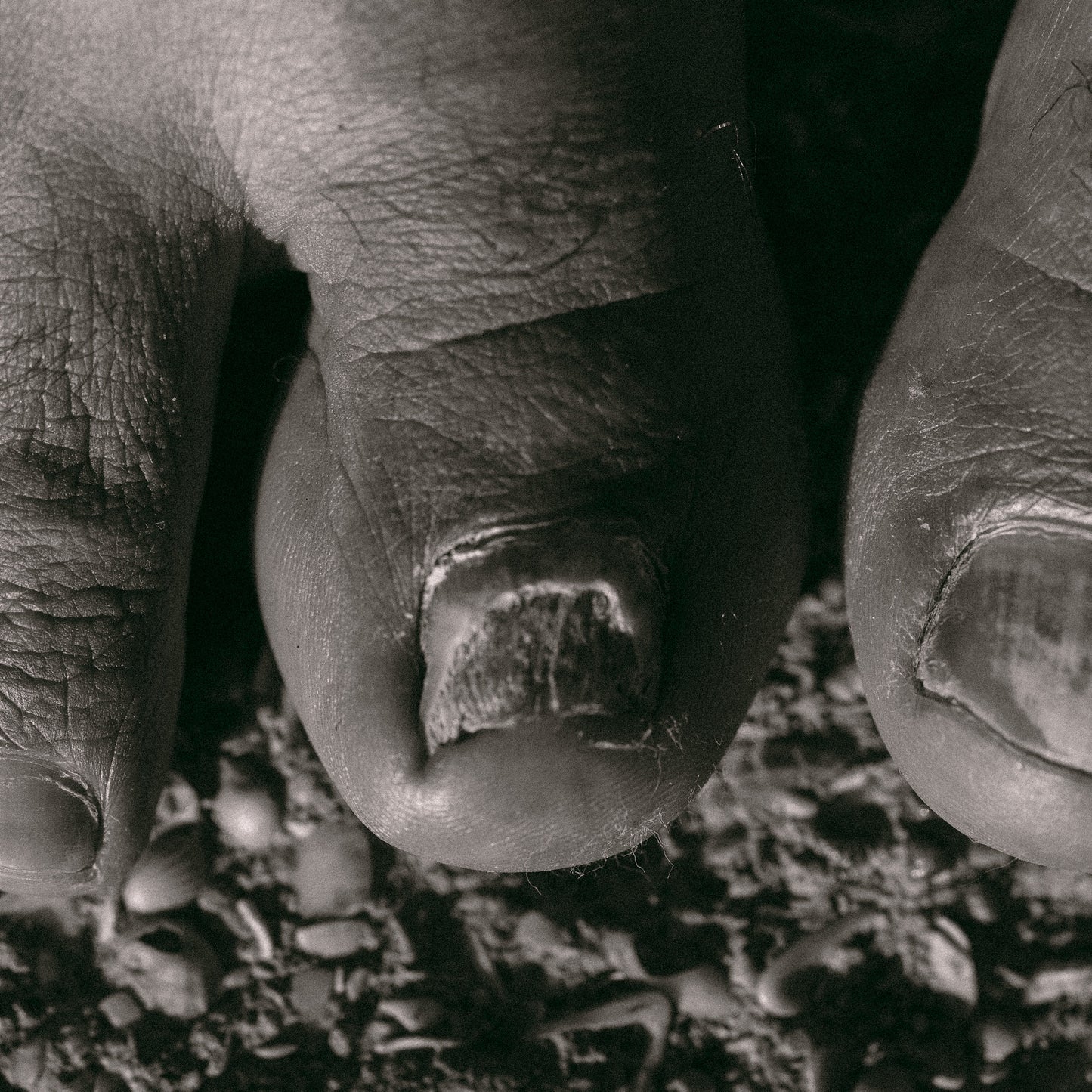 Candida, H.Pylori and SIBO Healing Bundle