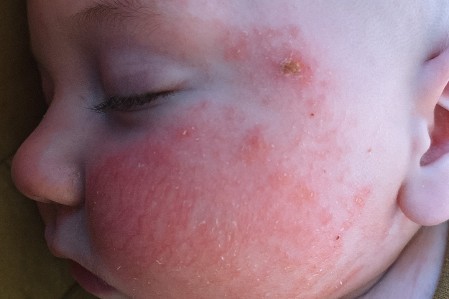 My Biggest Regret While Healing My Son, and How You Can Avoid It | 196
