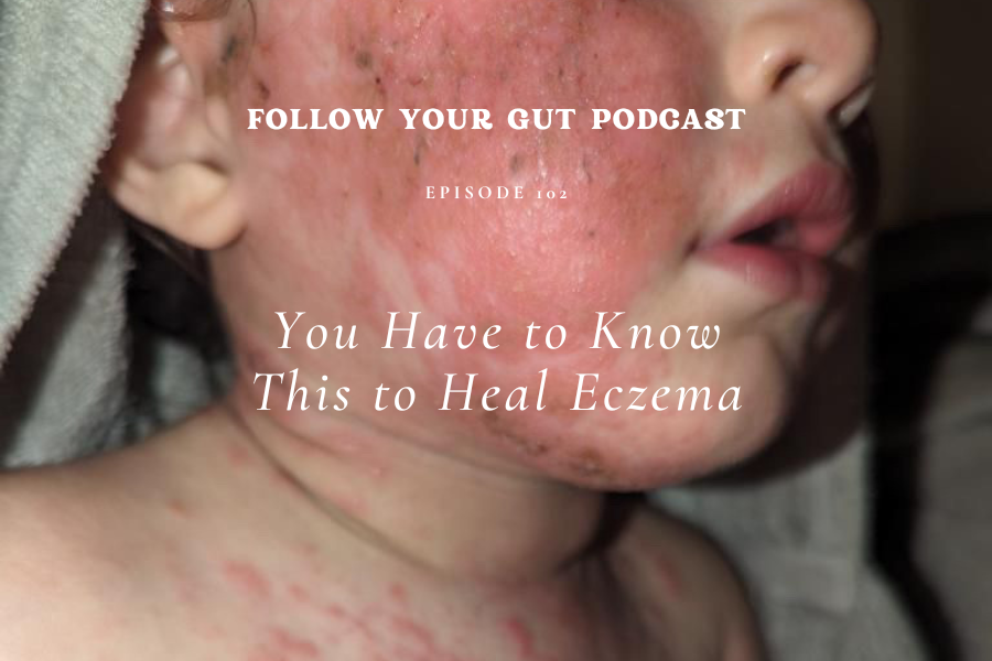 You Have to Know This to Heal Eczema